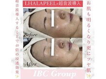 IBC 上大岡店/大人気のララピール