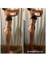 アヌヘア(Anuhea)/ボディ大会前インディバお仕上げ