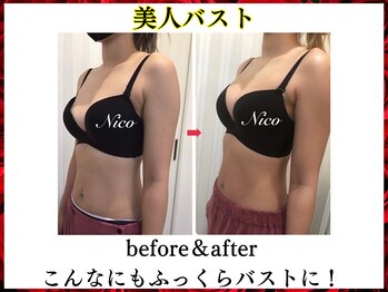 ニコ 岐南本店(Nico)/バスト★Before→after