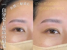トレミニョン(tres mignon)/ハリウッドブロウリフト認可店