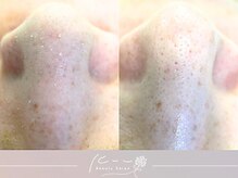 クウ(kuu)の雰囲気(角質ケアならkuuにお任せ★ゴッソリ爽快な毛穴ケアもできちゃう!)