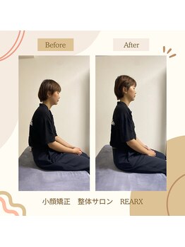 リアークス(REARX)/Before→After：たった1回の変化