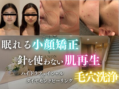 ラノン(LANON)の写真