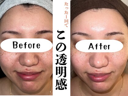 ハル(HARU.)の写真