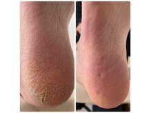 キラネイル(kirranail)の雰囲気(角質ケアふわふわに♪)