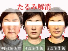 フレキシボディ(FlexiBody)の雰囲気（小顔矯正整体の回数を重ねる事で、より確実な小顔へ導きます！）