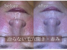 ブリエ(Briller)の雰囲気（エステの効果をより持続させたいお客様は自宅ケアからお見直しを）