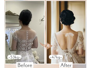 チュリ(Turi.)/20代女性（花嫁）Before・After