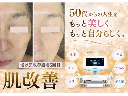 グラチア(Gratiae)の写真