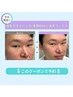 《新規/学割U24/人気No.2》美眉WAX+毛量調整(間引き/カット)×鼻毛WAX #眉毛