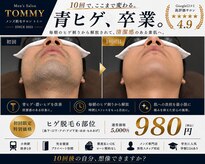 トミー(TOMMY)