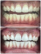 グラスプレイス/プレミアム症例　7