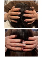 ルノン(LUNON)/小顔になりたい方におすすめ