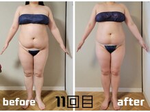 ラフォクシー(La.Foxy)/全身スリムコース