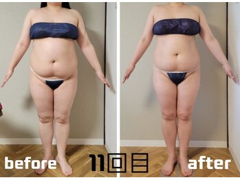 ラフォクシー(La.Foxy)/全身スリムコース