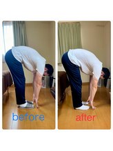 花巻ひふみ整骨院/猫背が原因の腰痛改善（男性）