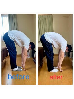 花巻ひふみ整骨院/猫背が原因の腰痛改善(男性)