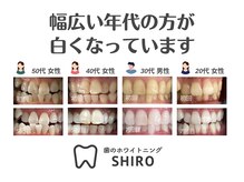 初めてでも大丈夫！ホワイトニングはスタッフと一緒に進めます♪