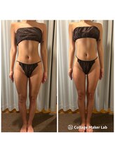 アヌヘア(Anuhea)/ボディ大会前インディバお仕上げ