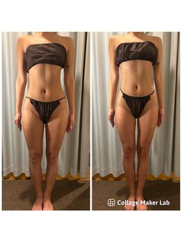 アヌヘア(Anuhea)/ボディ大会前インディバお仕上げ