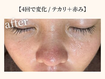 ドリームスパ 武蔵小杉店(DREAM SPA)/before→after