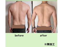 光幸はりきゅう院接骨院/痩身・ボディーメイクもお任せ☆