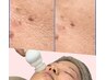 【再来限定】水素フェイシャル60分《初回から4週間以内リピート》