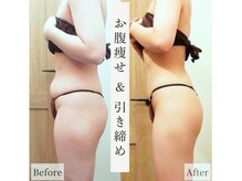 レイプラス 仙台店(RAY PLUS)の雰囲気（頑固な皮下脂肪は[ハイパーナイフ]★部分/全身痩せお任せ下さい!）