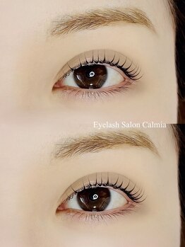 カルミア(Calmia)/施術イメージ