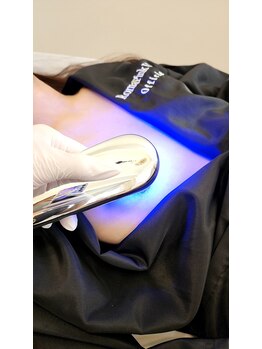 ローマピンク 札幌/本来の自然な色に戻すRomaPink