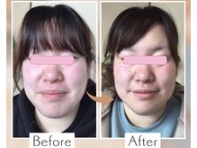 小顔コルギは痛すぎない心地よいお力加減で。デコルテ＆ヘッド付