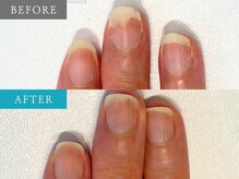 育爪 梅田店/育爪カルテ