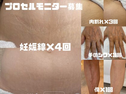 テセラ(Tethere)の写真