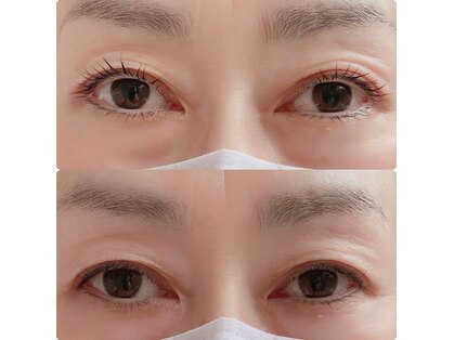 ソルイ(SOL_Y)の写真