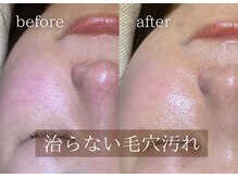 ブリエ(Briller)の雰囲気（ブログにて当店のハーブピーリングの良さと他店との違いを説明）