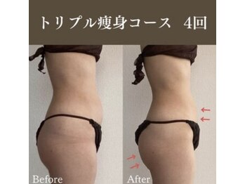 サロンドペシェ(salon de peche)/お腹がぺたん!ヒップアップも♪