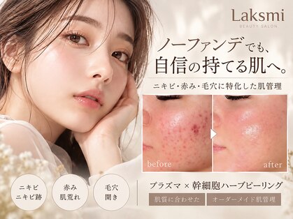 ラクシュミー(laksmi)の写真