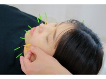 ポプラル鍼灸整体院/美容鍼も得意です！