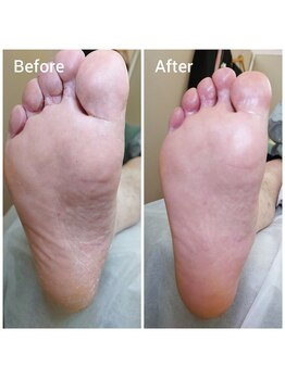 リゼラアンドコー 表参道店/