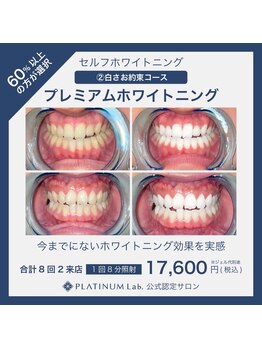 プラチナムビューティ 四条烏丸店(PLATINUM Beauty)/プレミアムホワイトニング