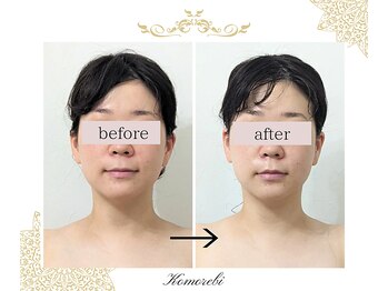 コモレビ(Komorebi)/ビフォーアフター