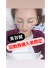 【美容鍼回数券購入者限定！】※回数券を持ってる方はこちらを選んでください