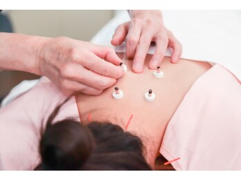 美容鍼灸salonまつもと/