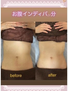 ルルアス(LuLuAS)/くびれウエストシェイプコース☆