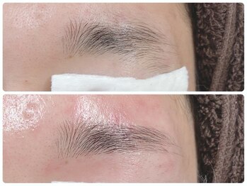 メイクマジック(Makemagic)/20代男性アイブロウワックス脱毛