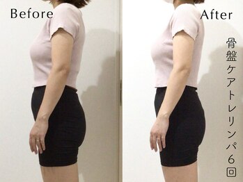 ペルビックハート(Pelvic Heart)/骨盤ケアトレリンパ6回