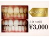 【☆再OPEN記念☆】5分照射×2回 ¥3,000（通常¥9,900）セルフホワイトニング