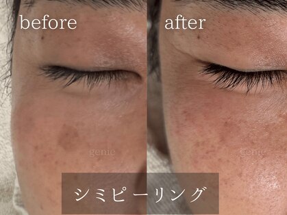 ジーニー(genie)の写真