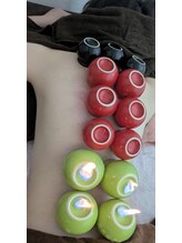 リデザイン 京都(REDESIGN)/中医カッピング療法