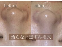 ブリエ(Briller)の雰囲気（骨髄幹細胞等を使用した鎮静トリートメント肌を休息させる◎）